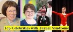 10 Celebrities with Turner Syndrome