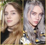 Billie Eilish Breast Reduction: a Journey Towards Self-Acceptance