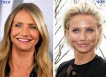 Cameron Diaz Breast Implants Plastic Surgery Before and After