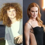 Did Nicole Kidman and Cosmetic Surgery: the Truth Revealed