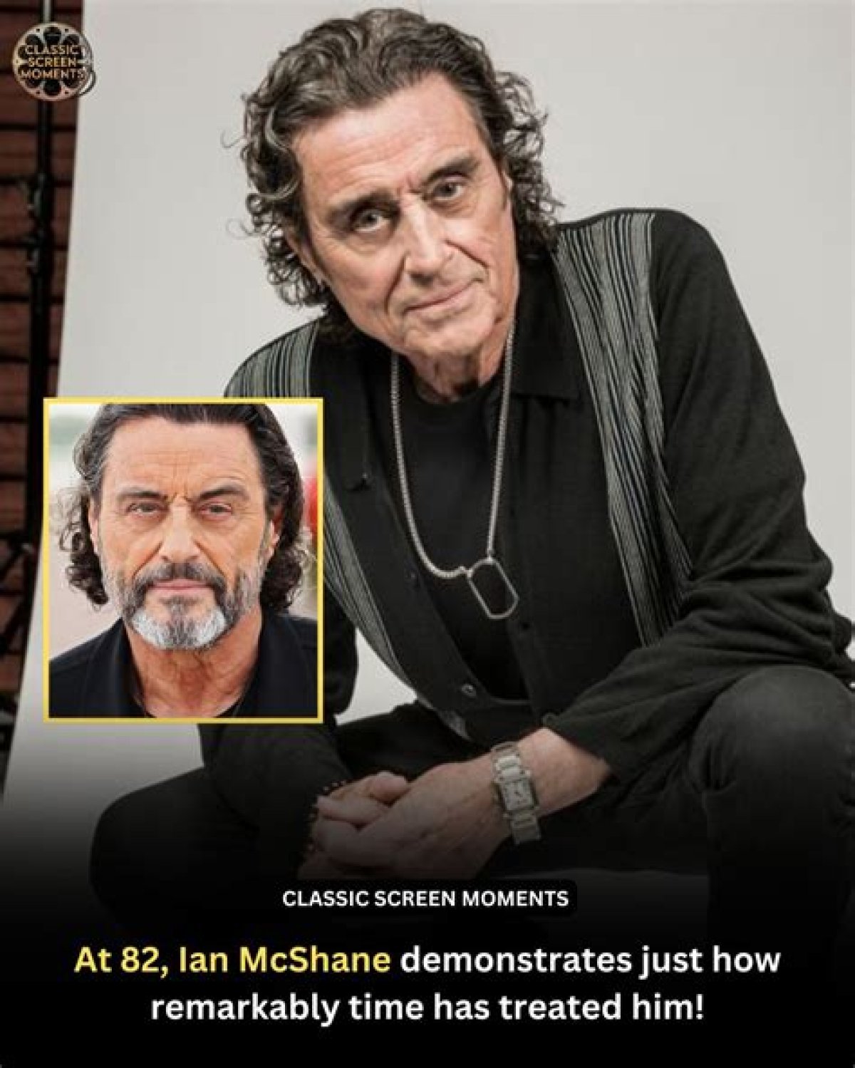 Does Ian Mcshane Have a Glass Eye? Actor Eye Related Injury and Condition Described |