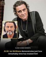 Does Ian Mcshane Have a Glass Eye? Actor Eye Related Injury and Condition Described |