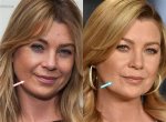 Ellen Pompeo's Lip Filler Journey: a Closer Look