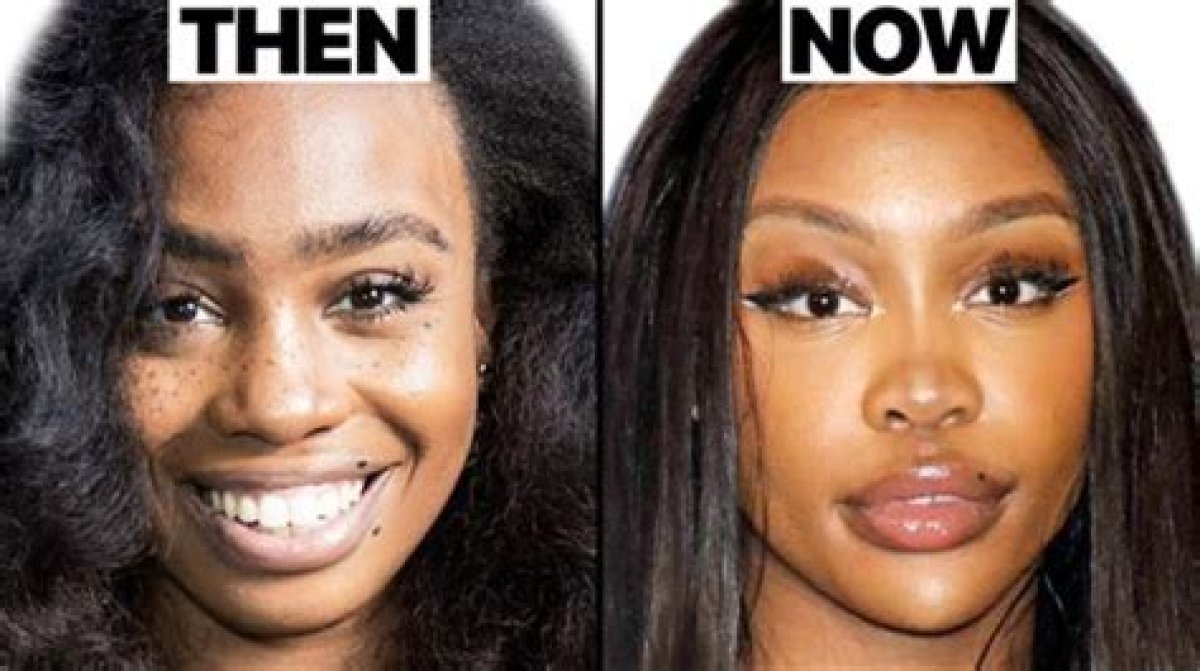 Exploring the Truth: Has Tyla Had Plastic Surgery?