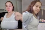 Hayley Atwells Breast Reduction: Before and After!