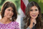 Kristi Noem's Plastic Surgery Transformation: Before and After