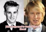 Owen Wilson's Nose: the Story Behind His Distinctive Feature