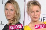 Renée Zellweger Plastic Surgery: the Transformation of an Icon