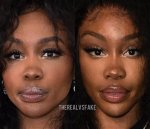 Sza Nose Job 2025: the Ultimate Guide to Her Transformation