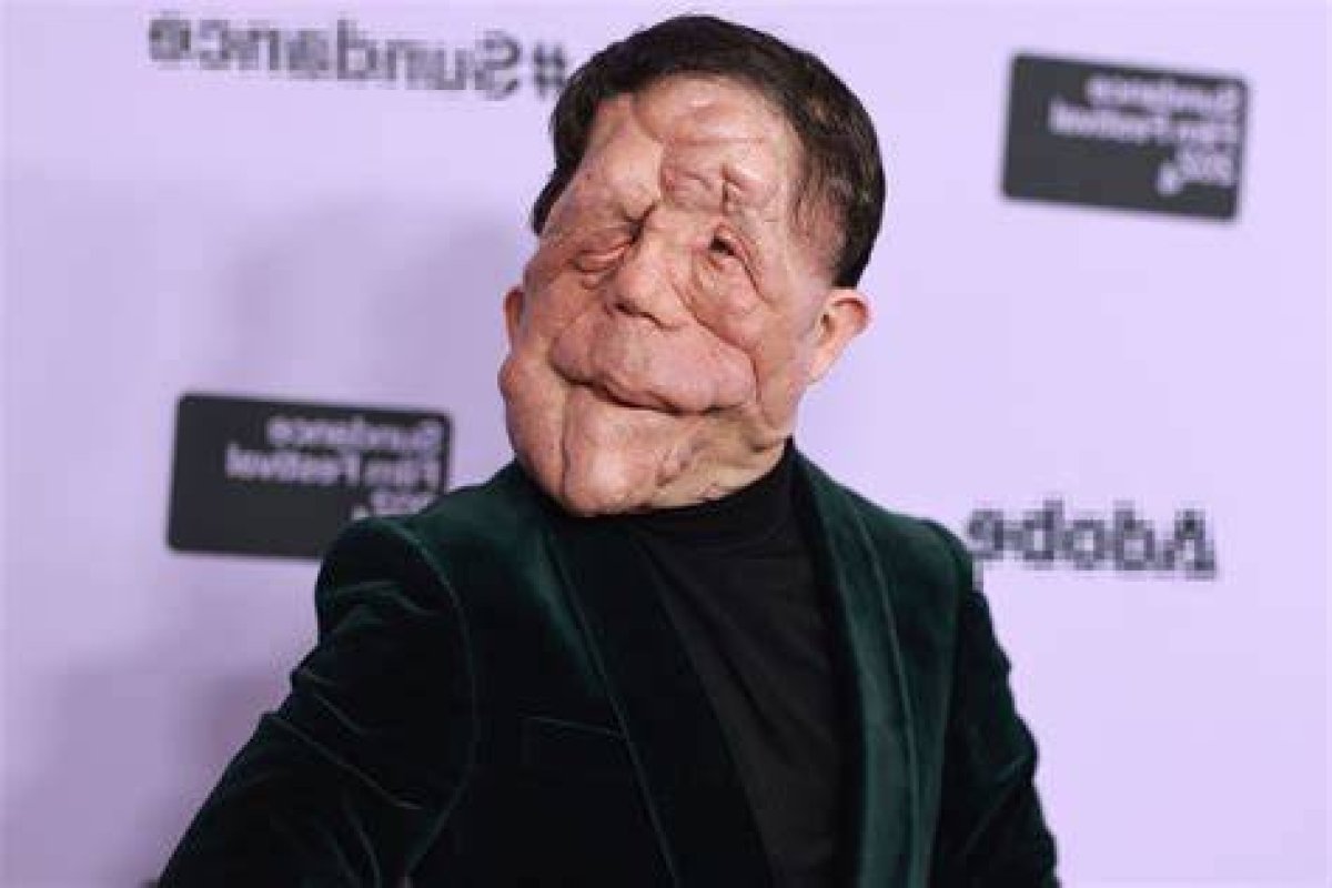 Understanding Adam Pearson's Girlfriend: a Deep Dive into His Personal Life