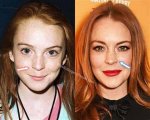 Unveiling Lindsay Lohan's Nose Job: Secrets and Revelations