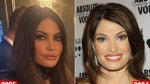 Unveiling the Truth Behind Kimberly Guilfoyle Lip Surgery