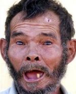 Unveiling the "Ugliest Man in the World"